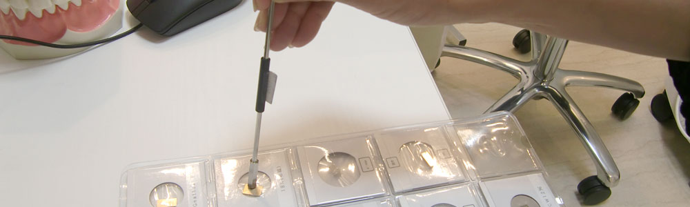 できるだけ金属を使わない治療