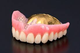 様々な入れ歯の画像