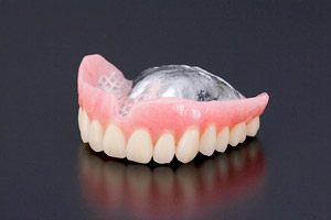 様々な入れ歯の画像