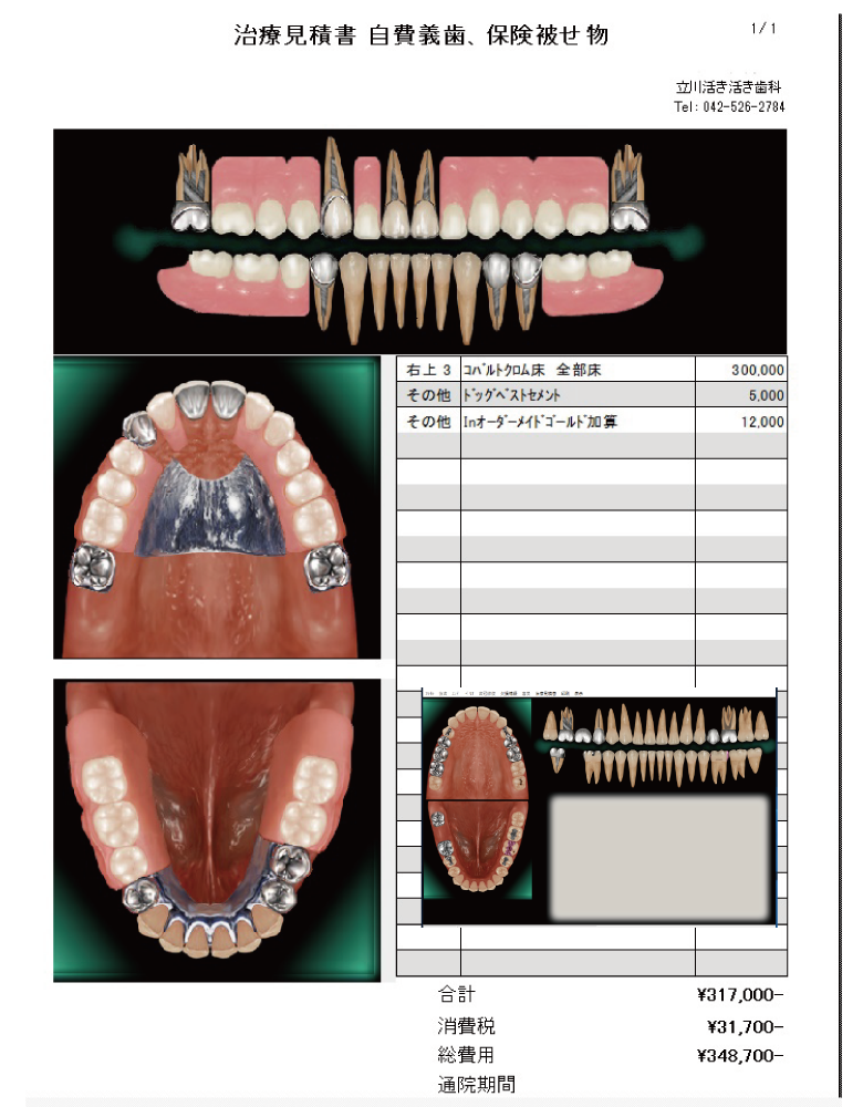 ISIシステム歯科治療計画システム画像