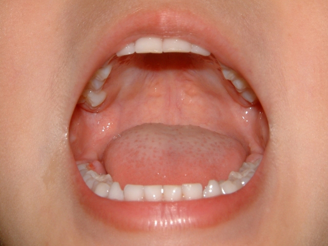 乳歯が永久歯に生え変わるメカニズム