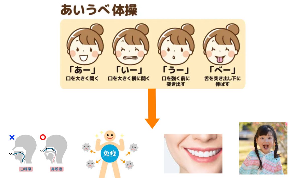 「簡単！“あいうべ体操”で歯と体の健康を守ろう」