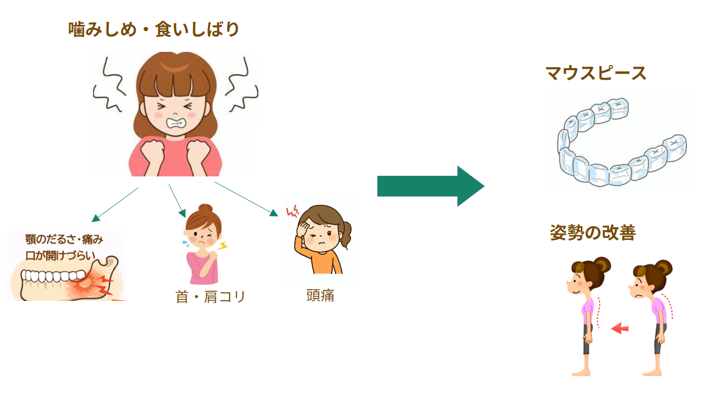 食いしばりと肩こりは関係ある？